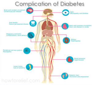 Complication of Diabetes