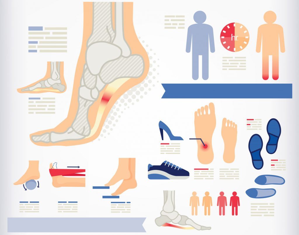 how to heal plantar fasciitis