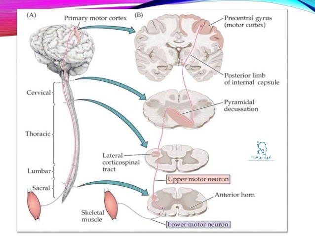 lower motor neuron lesions