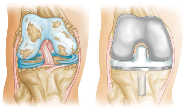 orthopedic surgeons in los angles