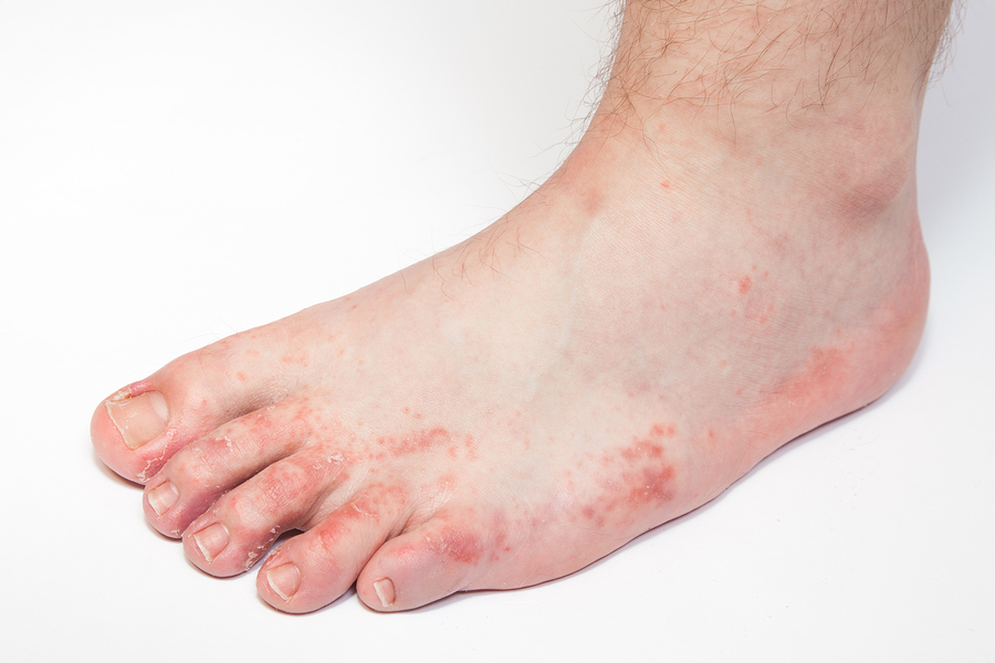 Foot Symptom Chart