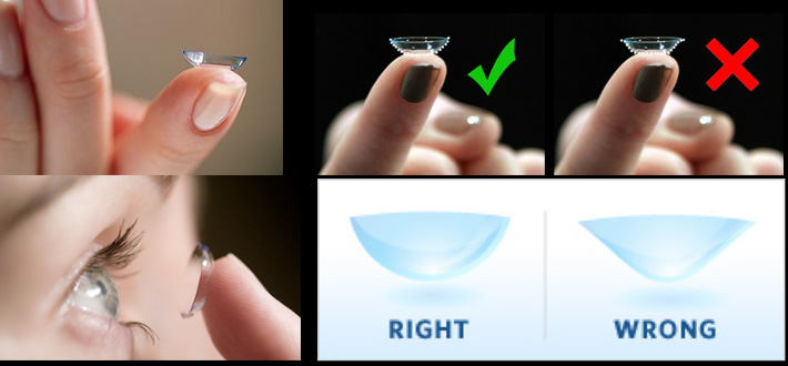 contact lens