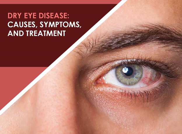 Dry Eye Syndrome: Causes, Symptoms & Treatment » How To Relief Dry Eye Syndrome: Causes, Symptoms & Treatment » How To Relief