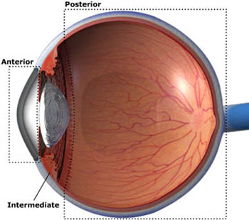 types of uveitis