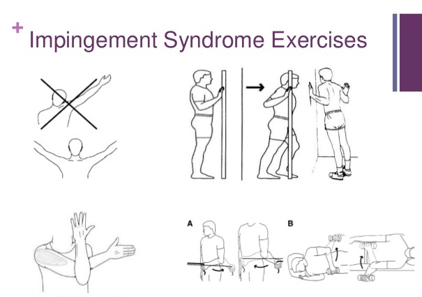 shoulder impingement diagnosis