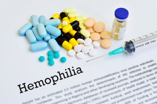 hemophilia treatment