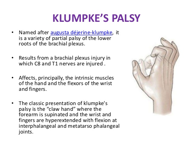 Klumpke Palsy